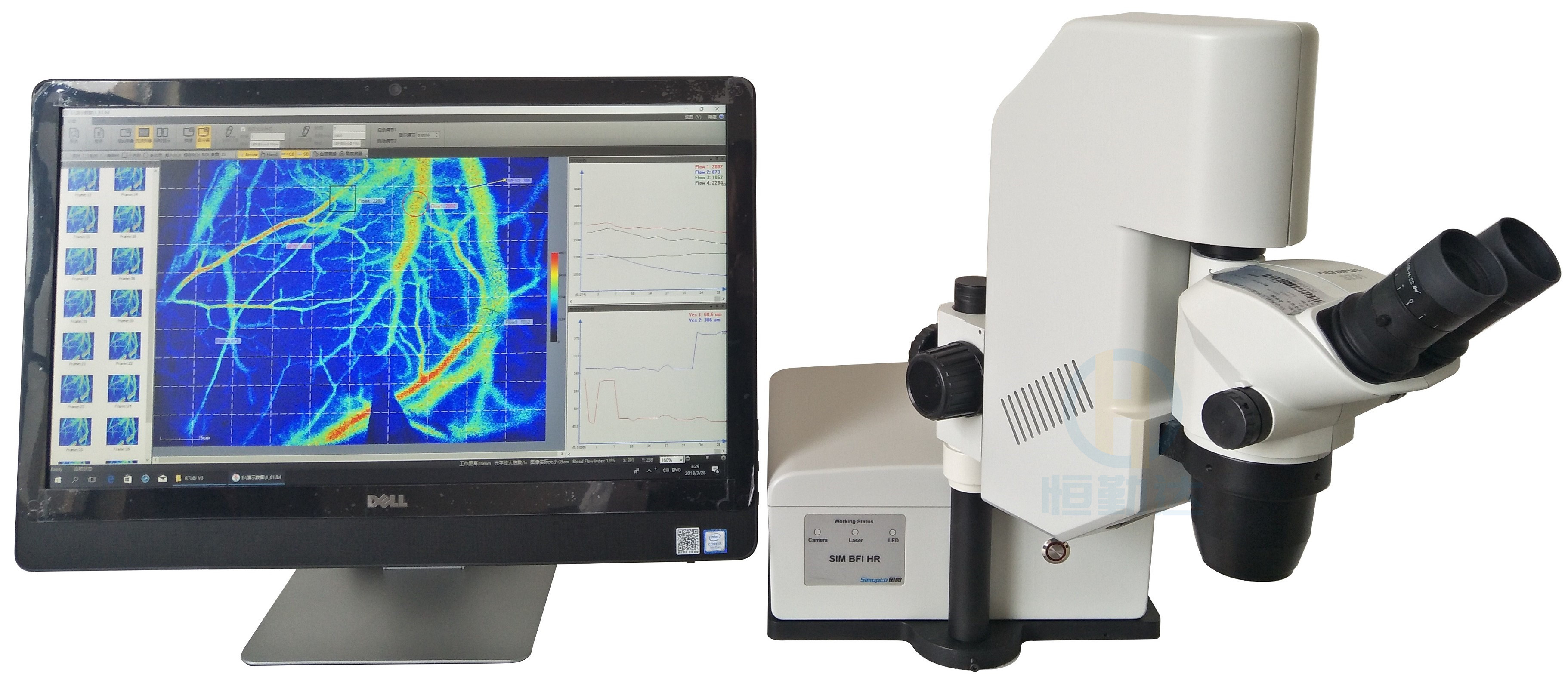 激光散斑血流成像仪